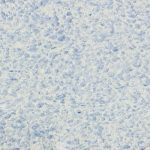 Штукатурка шелковая декоративная Silk Plaster Рельеф 326